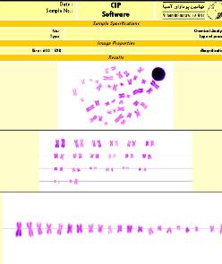 نرم ­افزار تخصصی شناسایی و دسته بندی کروموزوم ­های حیوانی